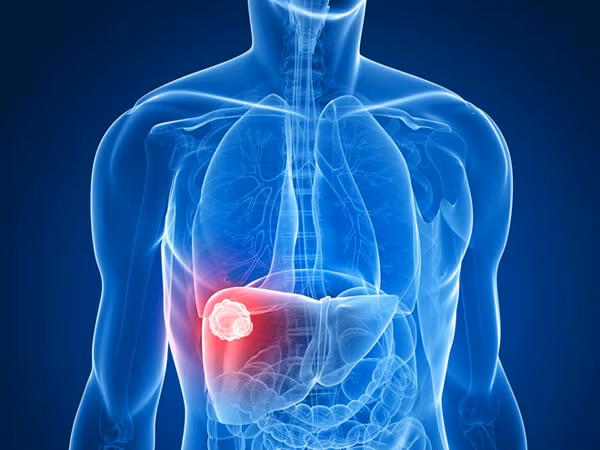 Để phát hiện sự bất thường ở gan, chuyên gia sức khỏe khuyên bạn nên chú ý đến các dấu hiệu bệnh gan buổi sáng dưới đây. Nếu có biểu hiện bất thường, bạn nên đi khám để phát hiện bệnh, điều trị kịp thời.