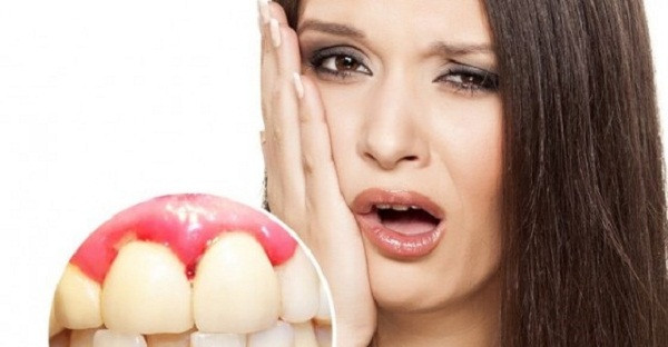 Ngoài ra, chảy máu nướu còn bắt nguồn từ việc cơ thể thiếu các yếu tố đông máu do gan tổng hợp. Nguyên nhân bởi khi chức năng gan suy giảm, nó khó có thể đảm bảo nhiệm vụ này. Vì vậy, bạn cần đặc biệt chú ý đến sức khỏe khi đối diện tình trạng chảy máu nướu thường xuyên.