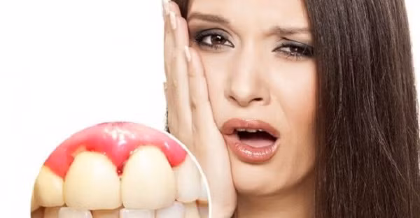 Ngoài ra, chảy máu nướu còn bắt nguồn từ việc cơ thể thiếu các yếu tố đông máu do gan tổng hợp. Nguyên nhân bởi khi chức năng gan suy giảm, nó khó có thể đảm bảo nhiệm vụ này. Vì vậy, bạn cần đặc biệt chú ý đến sức khỏe khi đối diện tình trạng chảy máu nướu thường xuyên.