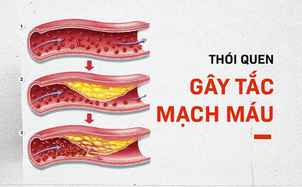 Để làm “mềm” mạch máu, bạn nên hạn chế đồ chiên nướng, ăn nhiều rau củ. Những thực phẩm như hành tây, súp lơ, củ cải, bầu sáp, nấm, cà chua, đậu nành... chứa nhiều axit béo không no, có khả năng giúp mạch máu tăng tính đàn hồi rất được khuyến khích trong thực đơn hàng ngày, giúp cơ thể tráng kiện, sống lâu.