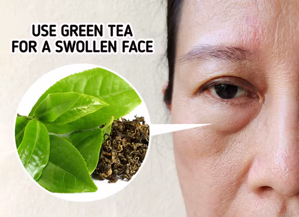 Đắp trà xanh. Cuối năm bận rộn, nhiều người phải thức khuya để hoàn thành công việc. Điều này khiến da mặt dễ mọc mụn, xuất hiện quầng thâm, bọng mắt...