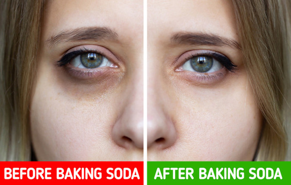 Chống quầng mắt bằng baking soda. Thức khuya chạy deadline sẽ khiến bạn đối diện tình trạng thâm quầng mắt chỉ sau vài đêm. Lúc này, bạn có thể tận dụng baking soda kết hợp với sữa để massage nhẹ nhàng. Natri trong baking soda có tác dụng chống viêm, khử trừng, giảm vết thâm hiệu quả.