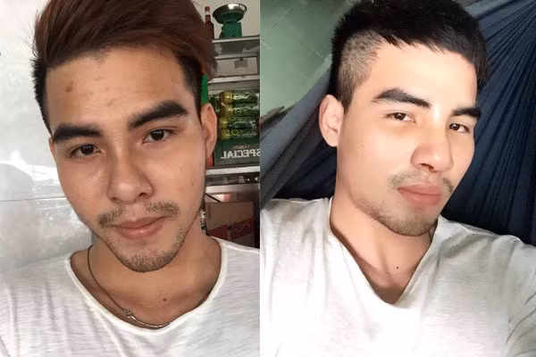 Chang trai mot nam sua mui 4 lan va cai ket so toi gia-Hinh-2