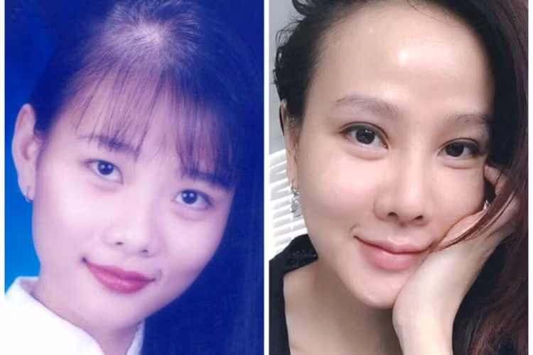 Tháng 10/2015, sau cuộc hôn nhân thứ 2 tan vỡ, Dương Yến Ngọc trở lại với diện mạo mới và công khai dao kéo. Cô thoải mái chia sẻ rằng bản thân đã sửa mũi, chỉnh bọng mắt và cấy mỡ lên mặt. Ảnh: FBNV