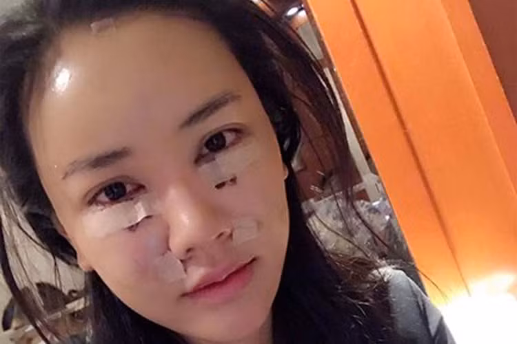 Maya cho biết, cô đã bỏ ra 600 triệu đồng để làm lại mặt. Nữ ca sĩ sinh năm 1988 cho rằng sống trong giới giải trí mà giờ cô mới đụng tới dao kéo là quá trễ. Ảnh: FBNV