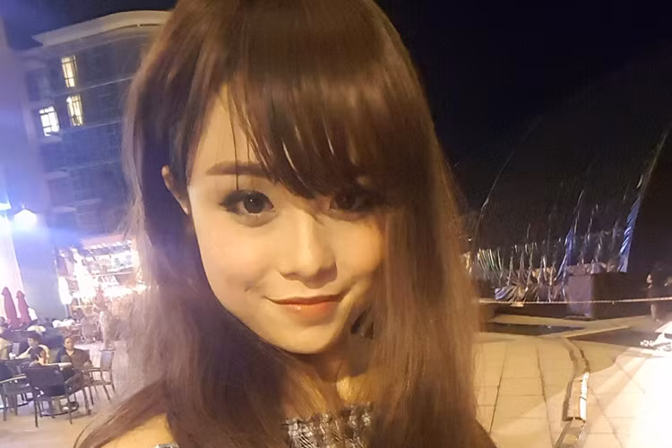 Thái Trinh cho hay, trước đây, vì những khuyết điểm trên gương mặt nên cô không mấy tự tin vào bản thân. Bởi vậy, cô quyết định dao kéo mũi và mắt. Quá trình dao kéo của Thái Trinh chỉ diễn ra trong ba tiếng đồng hồ. Ảnh: FBNV