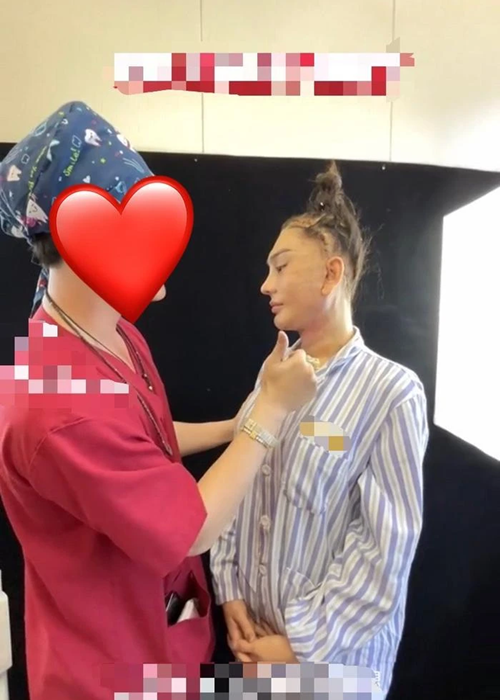 Trước khi căng da mặt, hồi tháng 8, Lâm Khánh Chi chỉnh sửa mũi. Ảnh: Saostar.