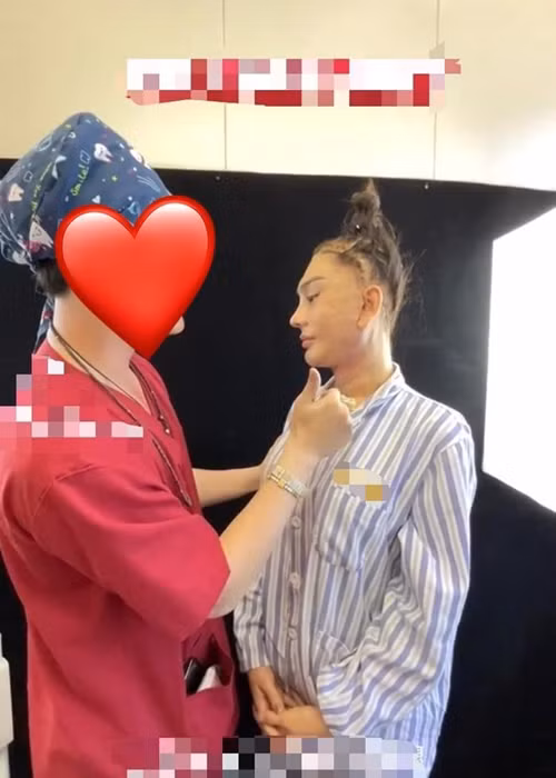 Trước khi căng da mặt, hồi tháng 8, Lâm Khánh Chi chỉnh sửa mũi. Ảnh: Saostar.