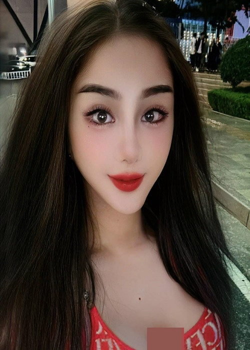 Lâm Khánh Chi khoe nhan sắc sau 7 ngày căng da mặt. Ảnh: FBNV.