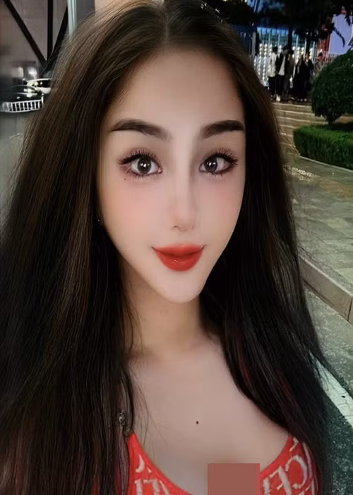 Lâm Khánh Chi khoe nhan sắc sau 7 ngày căng da mặt. Ảnh: FBNV.