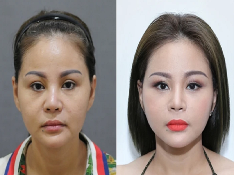 Bị nhiều cư dân mạng chê nhan sắc sau dao kéo, Lê Giang cho biết, cô vui vẻ đón nhận. Theo Lê Giang, cô phẫu thuật thẩm mỹ là để bản thân hoàn hảo hơn chứ không phải đã đẹp rồi nhưng vẫn cố tình đi chỉnh sửa. Ảnh: Saostar.