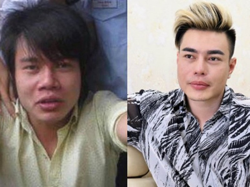 Lê Dương Bảo Lâm 2 lần thi trượt vào trường Sân khấu Điện ảnh. Nhận ra nhược điểm về ngoại hình, anh bán dây chuyền của mẹ được 10 triệu để sửa mũi, mượn bạn thêm 3 triệu để trả viện phí. Sau đó, nam diễn viên đậu vào trường Sân khấu điện ảnh. Ảnh: Sức Khỏe Cộng Đồng.