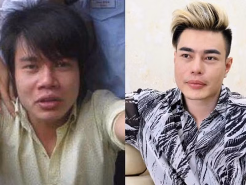 Lê Dương Bảo Lâm 2 lần thi trượt vào trường Sân khấu Điện ảnh. Nhận ra nhược điểm về ngoại hình, anh bán dây chuyền của mẹ được 10 triệu để sửa mũi, mượn bạn thêm 3 triệu để trả viện phí. Sau đó, nam diễn viên đậu vào trường Sân khấu điện ảnh. Ảnh: Sức Khỏe Cộng Đồng.