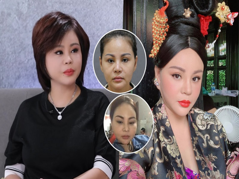 Không chỉ Lâm Khánh Chi, nhiều sao Việt cũng "nghiện" phẫu thuật thẩm mỹ. Lê Giang là một trong số đó. Nữ diễn viên chia sẻ, vì số lần chỉnh sửa quá nhiều nên chính cô cũng không nhớ đã phẫu thuật thẩm mỹ bao nhiêu lần. Ảnh: Saostar.