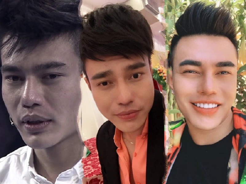 Ngoài sửa mũi, nam diễn viên hài còn thêu chân mày, nhấn mí mở tròng, tẩy môi thâm, làm răng, tiêm mặt, gọt hàm. Lê Dương Bảo Lâm thừa nhận, anh có sở thích mỗi năm làm một bộ răng sứ mới. Ảnh: Phụ Nữ Việt Nam.