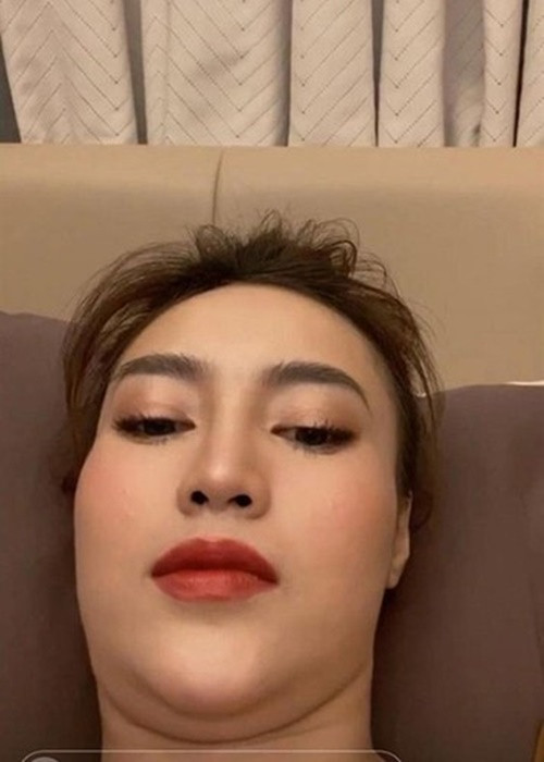 Lan Ngọc không ngại chia sẻ hình ảnh chụp cận mặt, khoe nọng cằm. Ảnh: FBNV.