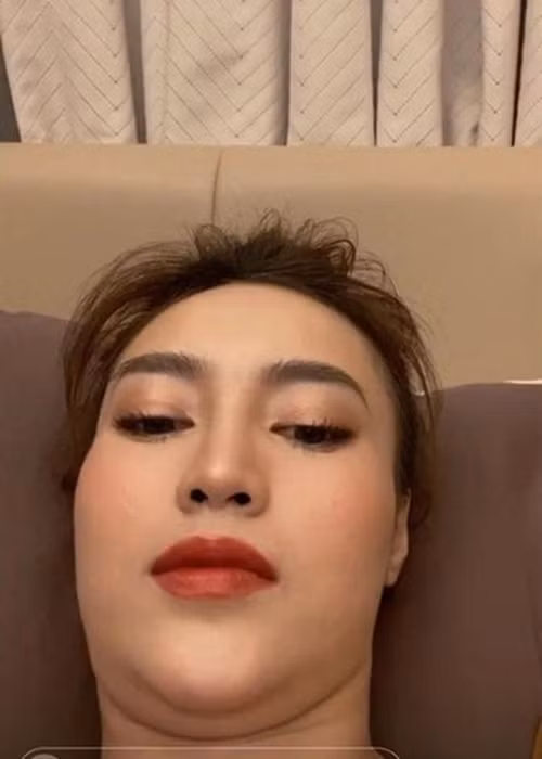Lan Ngọc không ngại chia sẻ hình ảnh chụp cận mặt, khoe nọng cằm. Ảnh: FBNV.