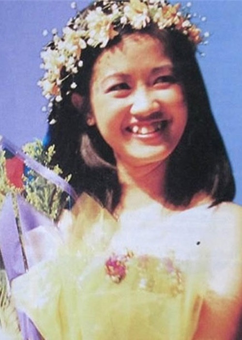 Khi gần tuổi 40, Hồng Nhung niềng răng vì vấn đề nhan sắc lẫn sức khỏe. Ảnh: Dân Việt.