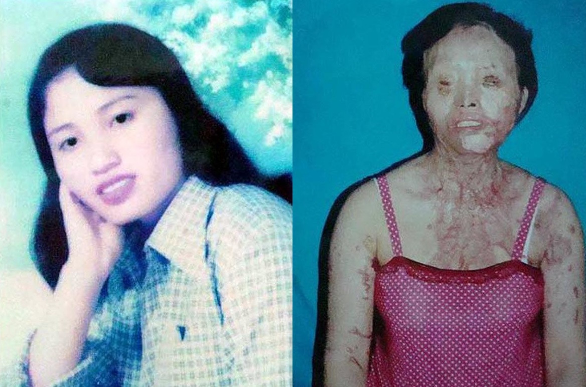 Cô giáo Phạm Thị Hương (SN 1982, quê Hà Tĩnh) và Cà Mau làm giáo viên năm 2005. Đêm 20, rạng 21/4/2006 khi Lương nằm ngủ trong phòng, thì bị một ca axít tạt vào mặt và cổ từ cửa sổ. Hai mắt chị Lương hoàn toàn mù, gương mặt biến dạng, nhiều chỗ ở cổ, vai bị bóc da nhăn nhúm. Hiện nay vẫn chưa bắt được thủ phạm.