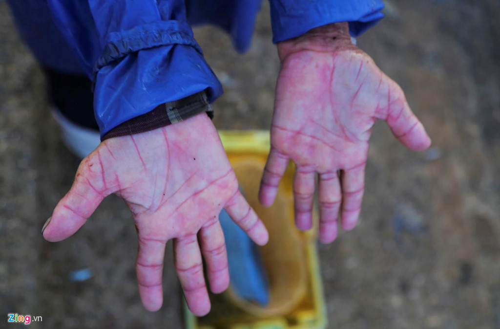 Cường độ làm việc thường xuyên, tiếp xúc với cá tươi và nước biển khiến làn da tay của họ săn lại, nhiều người bị bong tróc da bởi vị mặn của biển.