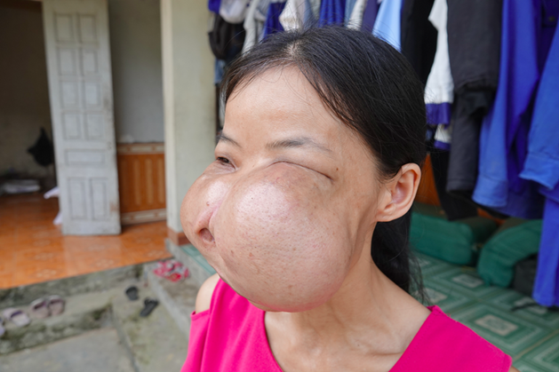 Nguoi phu nu 15 nam mang 