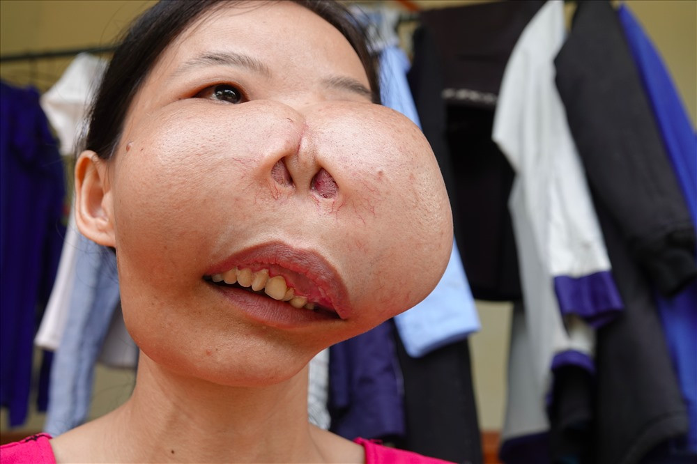 Nguoi phu nu 15 nam mang 