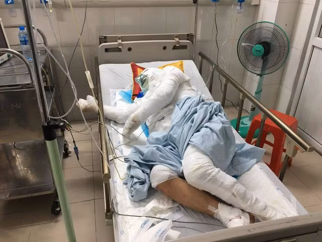 O to tong xe thuong binh o Ha Noi: Trich xuat camera truy tai xe-Hinh-2