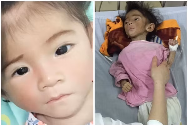 Yến Nhi tăng cân nhanh chóng, trở nên "có da có thịt" nhờ sự chăm sóc của mẹ Thanh Tâm cùng nhiều người tốt.