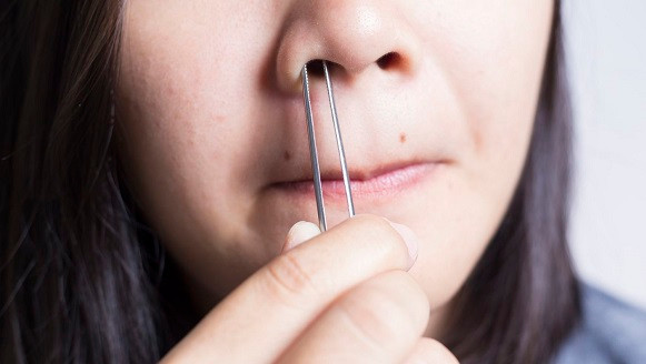 Đã từng có những trường hợp đáng tiếc như vậy, sau khi nhổ lông mũi, người nhổ bị nhiễm trùng dẫn đến sốt cao, ảnh hưởng đến não, thực sự là hoạ vô đơn chí.