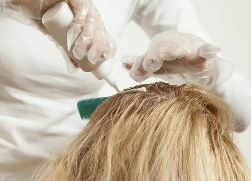 Moi thang nhuom toc 2 lan, co gai tre khien gan ton thuong nang