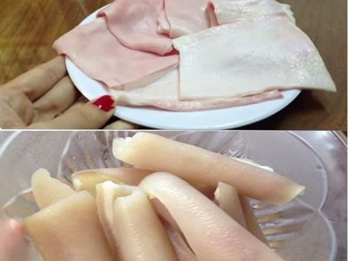 1. Bệnh gan Khi nạp quá nhiều chất béo dẫn đến hàm lượng triglycerid tăng lên đáng kể, gan sẽ tích trữ các thành phần mỡ thừa trong máu, lâu ngày dẫn đến gan nhiễm mỡ, tăng lipid máu và các bệnh lý về gan khác, khiến chức năng gan hoạt động không bình thường.