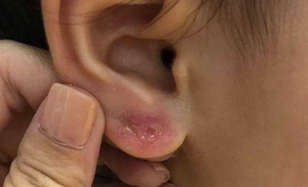 Xo khuyen tai khong can than, co gai gap chuyen ghe ron