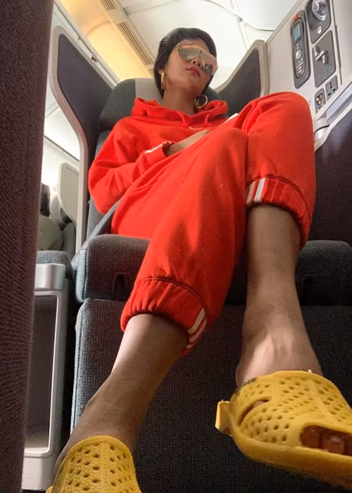 H'hen Niê chia sẻ lý do cô đi dép tổ ong bởi ngón chân bị mưng mủ, sưng to không thể mang giày thể thao hay giày cao gót. Đây là "chiến tích" sau thời gian cô tham gia ghi hình chương trình Cuộc đua kỳ thú. Ảnh: FBNV