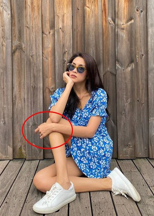 Căn bệnh khiến Tăng Thanh Hà giảm cân không phanh. Bản thân cô nhiều lúc không dám nhìn mình trong gương.