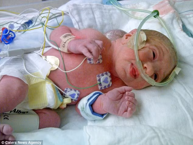 Mặc dù Isabella có thể phải đối mặt với những khó khăn trong cuộc sống khi lớn lên, nhưng đối với bố mẹ bé, cô con gái nhỏ của họ còn sống đã là một phép màu.