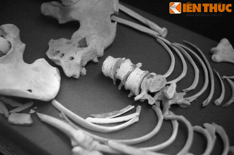 Đó là di thể của một trong 60 nạn nhân ở một hố chôn người tại huyện Vị Thủy, tỉnh Cần Thơ cũ, nay thuộc Hậu Giang. Những nạn nhân xấu số này bị quân đội Mỹ - Diệm tàn sát khi lập khu trù mật Vị Thanh - Hỏa Lựu năm 1959.