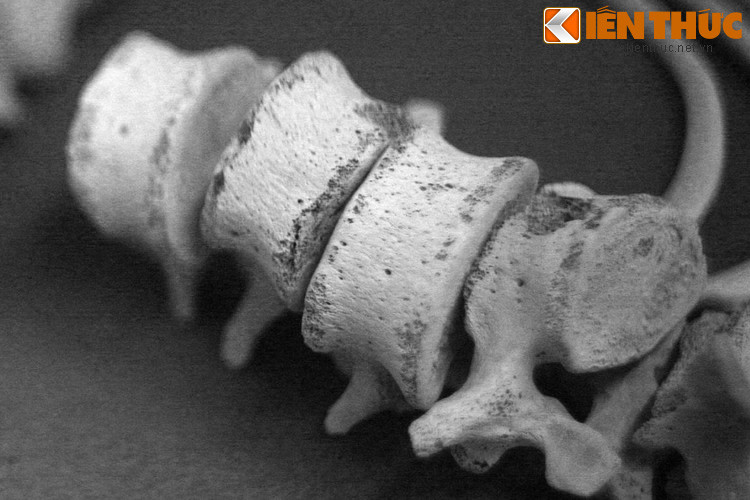 Để ghi dấu sự kiện đau thương này, khu trù mật Vị Thanh - Hỏa Lựu đã được công nhận là di tích lịch sử cấp quốc gia từ năm 1997.