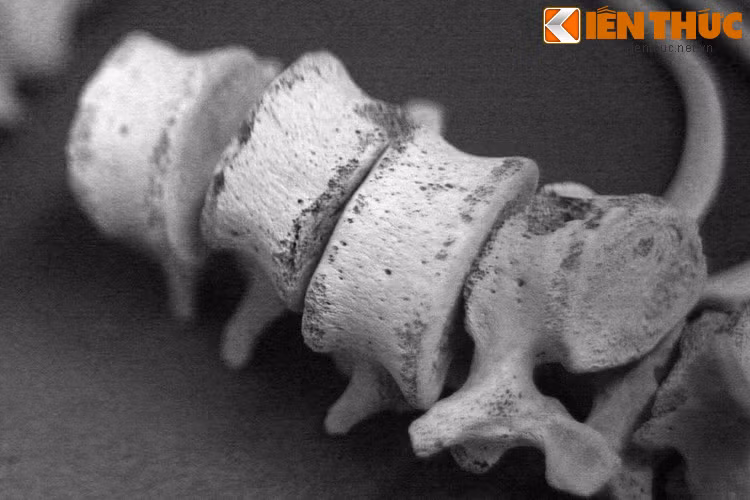 Để ghi dấu sự kiện đau thương này, khu trù mật Vị Thanh - Hỏa Lựu đã được công nhận là di tích lịch sử cấp quốc gia từ năm 1997.