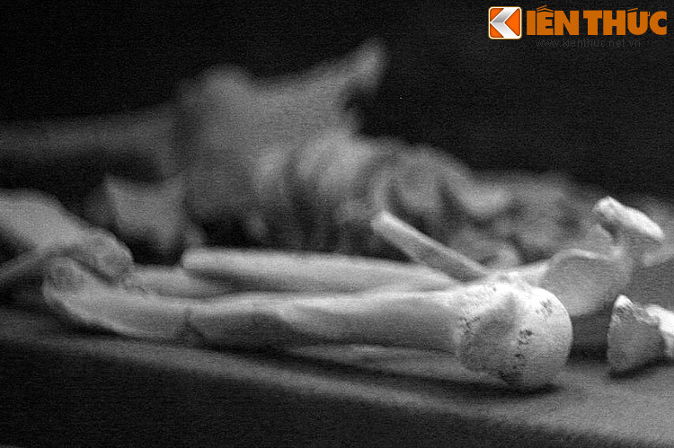 Theo các hồ sơ được tìm thấy, chỉ tính riêng trong tháng 5/1959 đã có hơn 390 người bị giết hại.