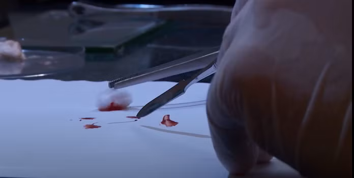 Dấu máu lập tức được đưa đi giám định, giải trình tự gien. Triệu tập toàn bộ các đối tượng hình sự, nghiện ma túy, bất minh về kinh tế và thời gian, Ban chuyên án thanh loại, lọc được 6 đối tượng có nhiều nghi vấn và bí mật theo dõi. (Ảnh: ANTV)