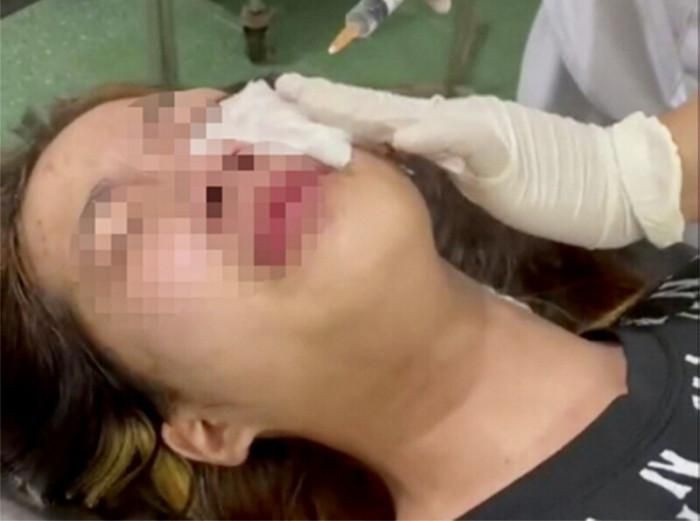  Điều tra nhóm đối tượng hành hung nữ sinh nhập viện: Ngày 25/9, Công an quận Đồ Sơn (Hải Phòng) cho biết, đang tiến hành điều tra vụ việc một nữ sinh lớp 10 bị nhóm nam thanh niên hành hung trên địa bàn. Danh tính nữ sinh bị hành hung là em H.T.T.V (SN 2006, trú quận Đồ Sơn, TP Hải Phòng). Nhóm này đã có lời lẽ xúc phạm, đánh đập em V. khiến nữ sinh phải nhập viện điều trị.