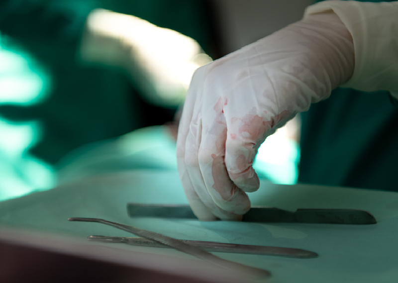 Theo ông, ngay cả khi tình trạng của một thương binh có thể được ổn định trên một chiếc ô tô đặc biệt trên đường đến bệnh viện, thì cuối cùng người lính đó vẫn phải vào cơ sở y tế mà không còn một quả thận. Tuy nhiên, nếu một người lính chết, anh ta sẽ được “niêm phong” trong túi đựng xác và điều gì xảy ra với thi thể tiếp theo thì không rõ, Lebedev nói. Ảnh: Reuters.