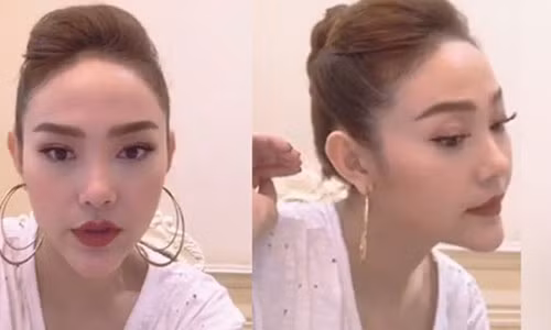 Hình ảnh cằm nhọn và như bị lệch sang một bên của Minh Hằng.