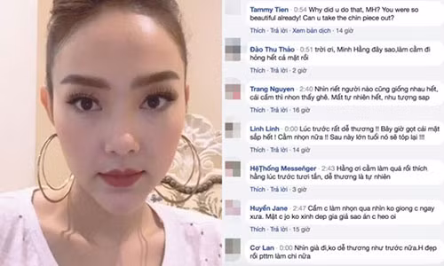 Khán giả bình luận rất nhiều về gương mặt nhọn hiện tại của Minh Hằng.