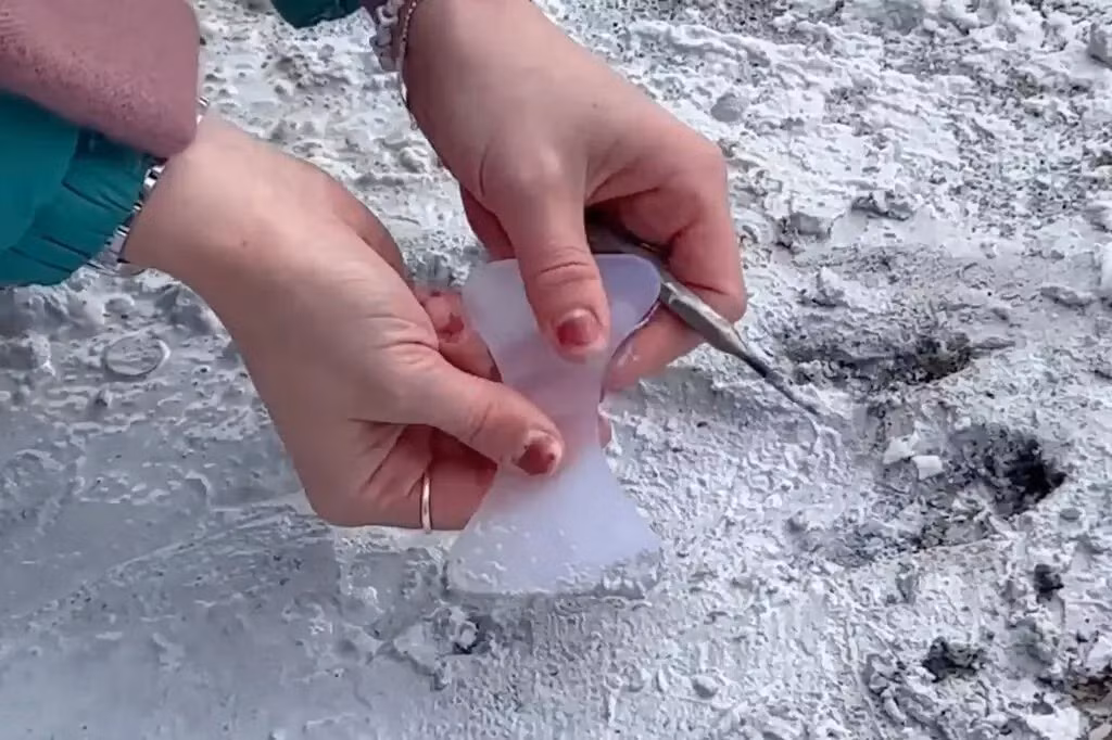 Vet lom gay sot o Chicago 'chet di, song lai'-Hinh-2