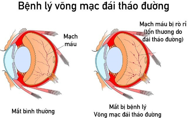 Cach kiem soat duong huyet trong mua dong