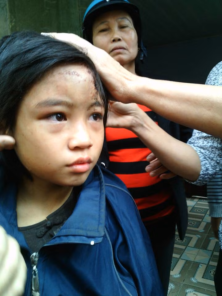 Be gai nghi bi bao hanh trong chua: Su tru tri co xao ngon?-Hinh-2