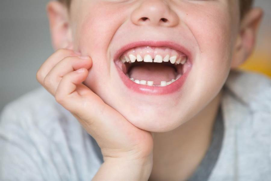 Ly ky cau be moc rang trong tinh hoan... phat hien khong tuong