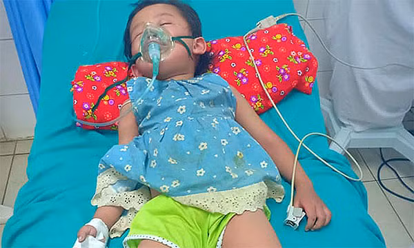 Sau 5 phut bi kien dot, be 3 tuoi o Tuyen Quang soc phan ve