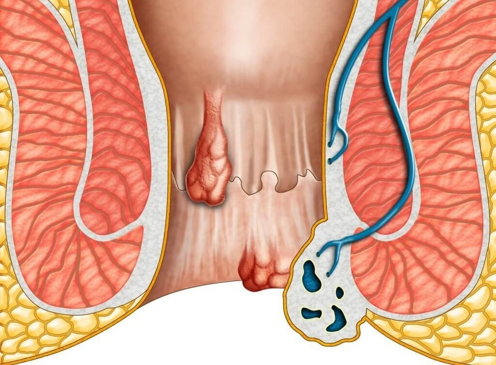 Mac benh kho noi, nguoi dan ba song chung voi tri 30 nam